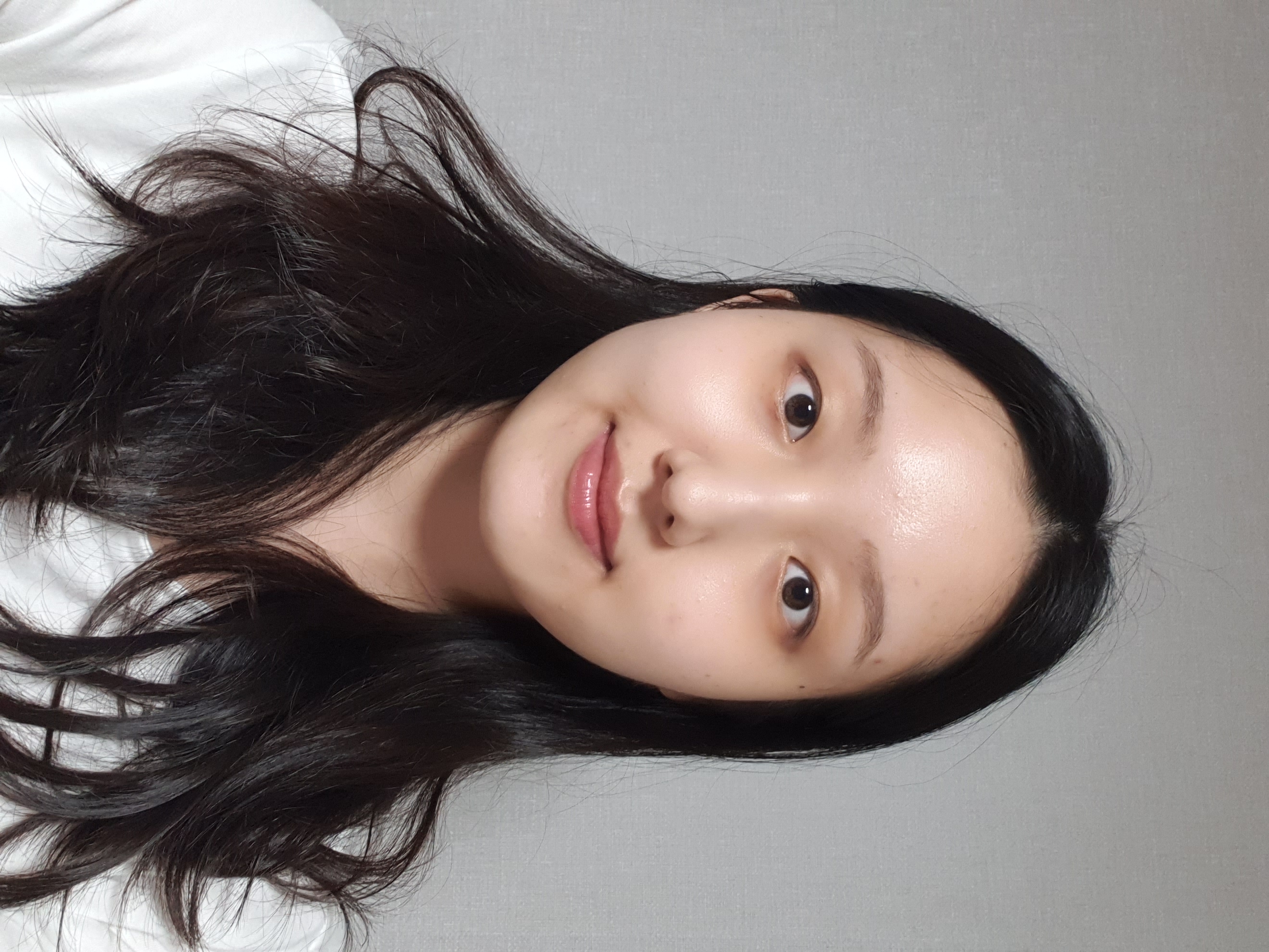 This is the review of the 1st week of double eyelid surgery. ?