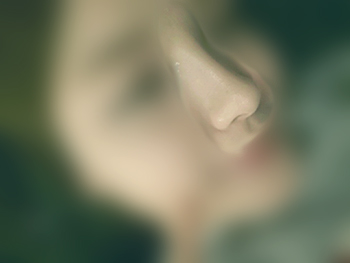복Rhinoplasty수술했어용!! 5개월차네여~