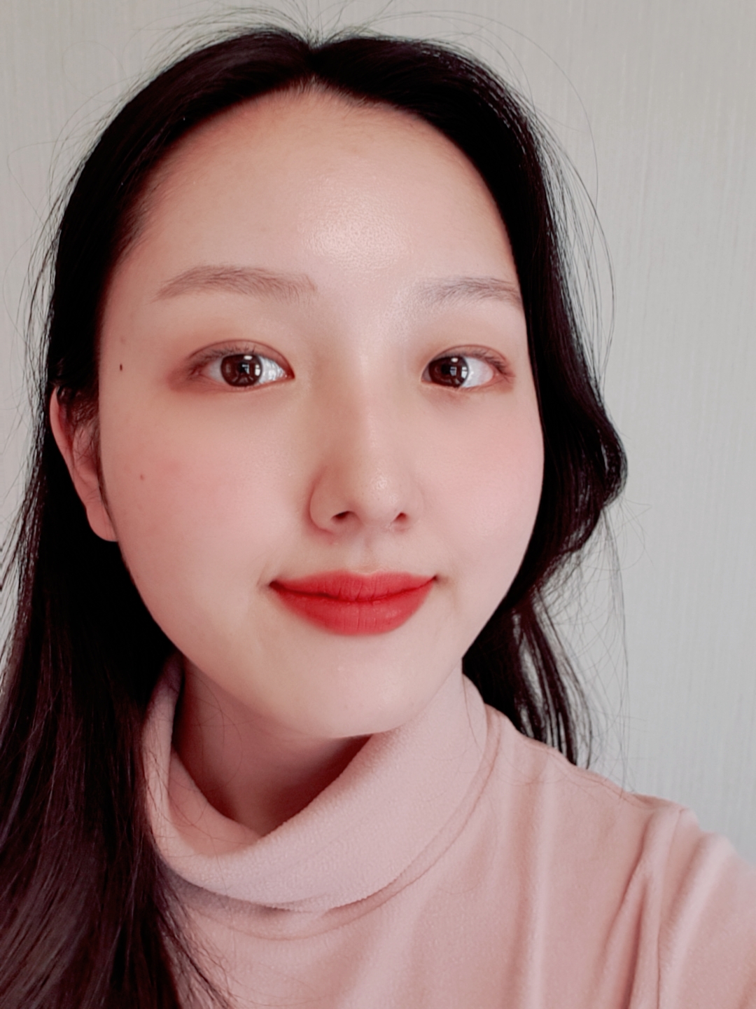 Double eyelid surgery 3 months later ?