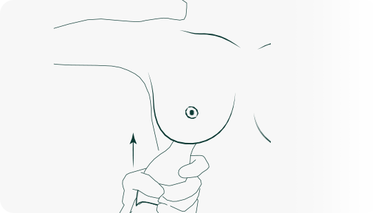 Tissue Expansion