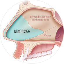 비중격연골