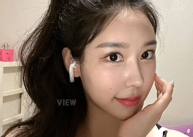 [Eyes Surgery / Rhinoplasty] Getting plastic surgery was the best decision I made this year!!
