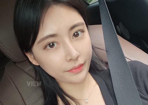 [Double Eyelid Surgery+Rhinoplasty+Fat Graft+Face Liposuction] I don’t know why I hesitated and postponed the surgery, I should have done it sooner without overthinking.