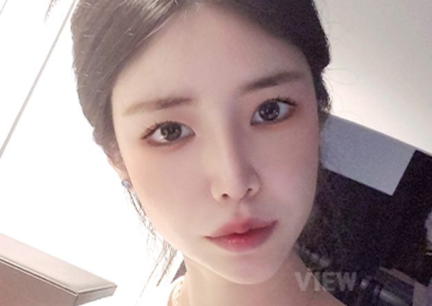 [Facial Contouring / Rhinoplasty / Double eyelid surgery] I’m living a new life. Thank you so much, and I love you.