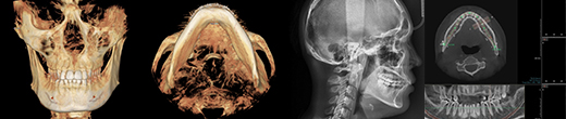 CT scan of View Plastic Surgery model