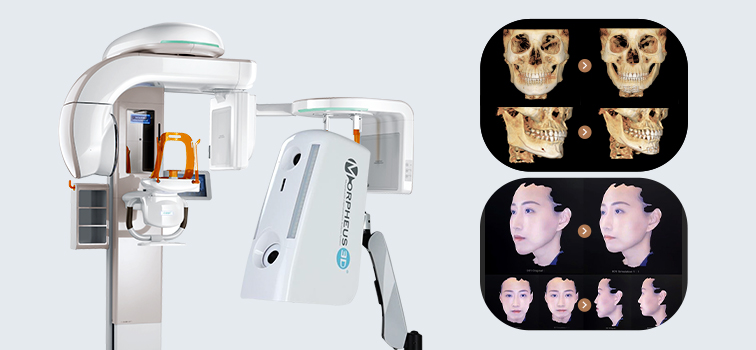 View Plastic Surgery uses various equipment, such as a 3D diagnostic system, to predict before and after surgery photos
