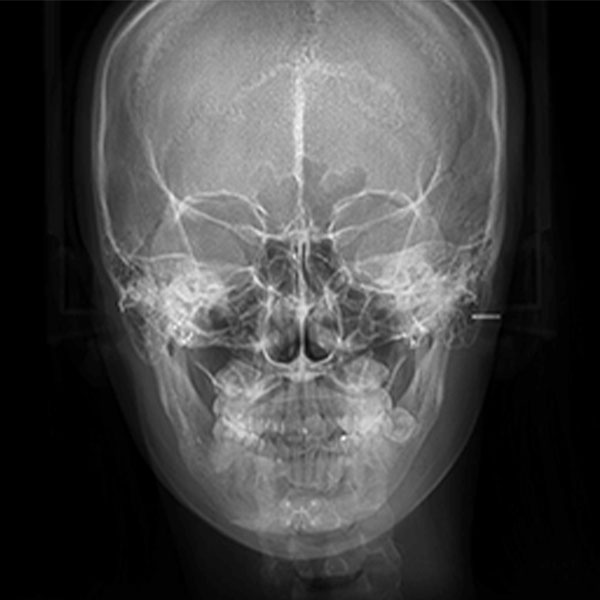 VIEW Safety System 49 safe medical mo2