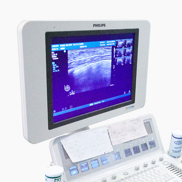 VIEW Safety System 55 safe medical mo5