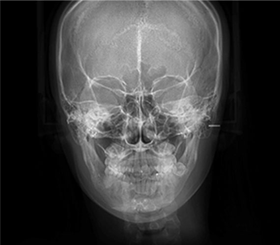 VIEW Safety System 48 safe medical pc2