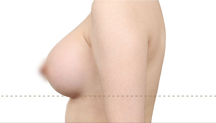 b l section02 4ea img01 mo