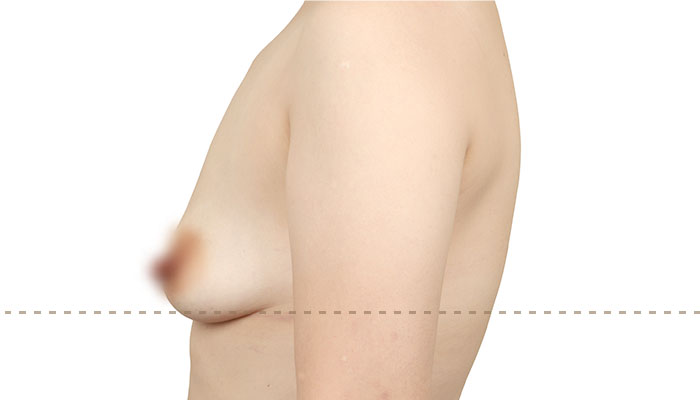 b l section02 4ea img02 mo