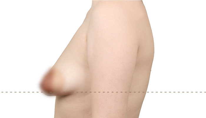 b l section02 4ea img03 mo