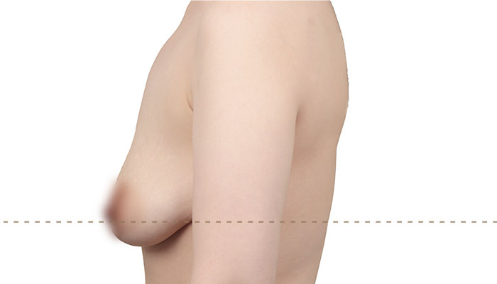 b l section02 4ea img04 mo