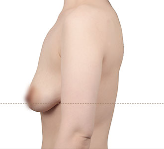 b l section02 4ea img04 pc