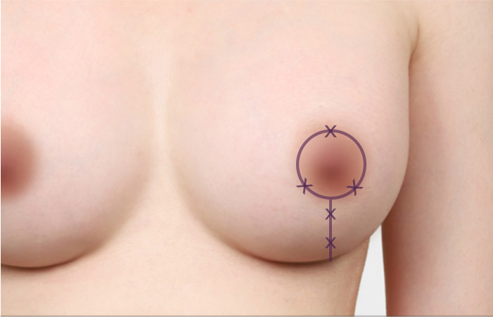 b r recommand img 06 mo 1