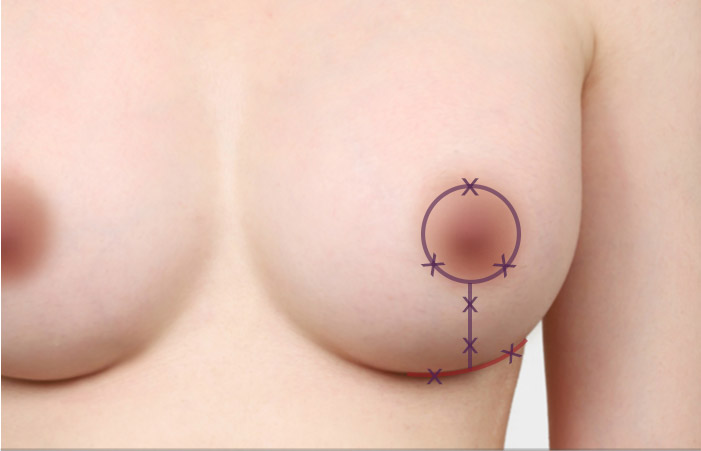 b r recommand img 07 mo 1