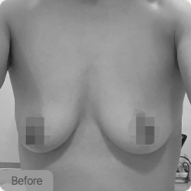 breast lift episode07 pc