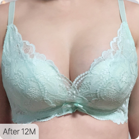 breast lift episode08 pc
