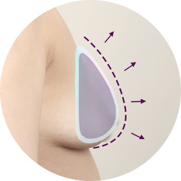 breast lift surgical01 pc