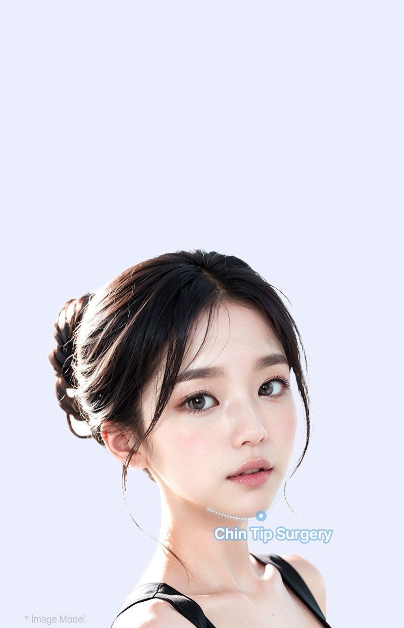 genioplasty sec02 mo