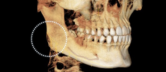 case01