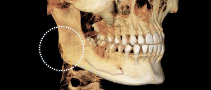 case01