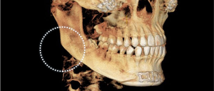 case01
