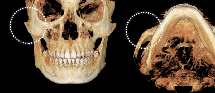 case01