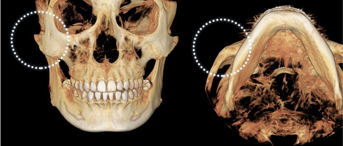 case01