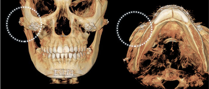 case01
