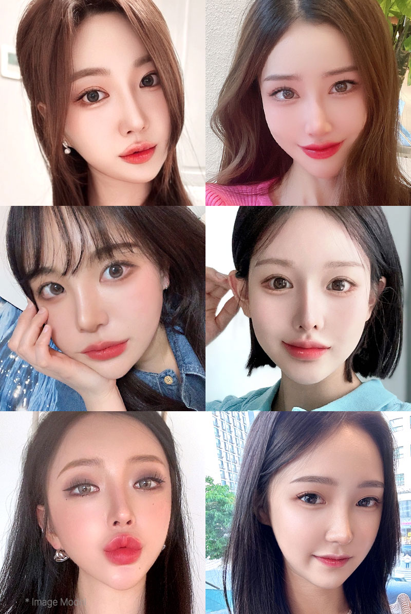 zygoma selfie mo