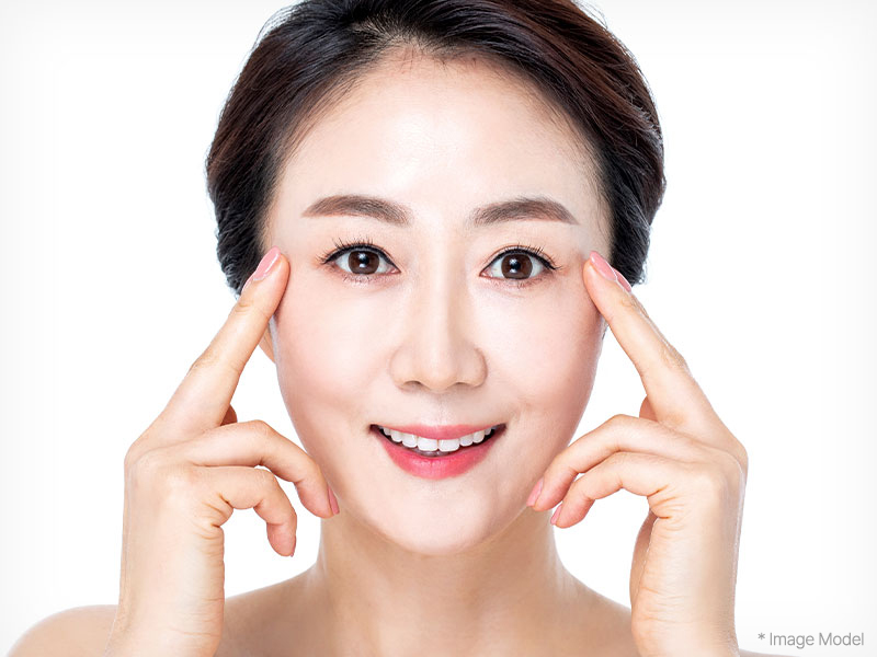browlift correct 01 mo