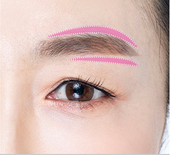 browlift step 01 pc