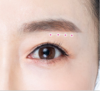 browlift step 03 pc