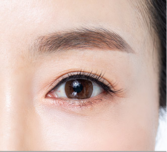 browlift step 04 pc