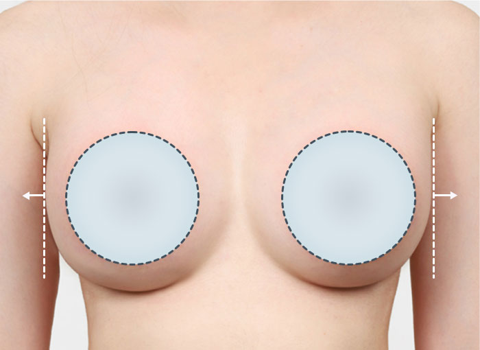 03. 크기/모양이 불만족인 경우