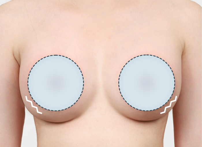 04. 리플링 현상