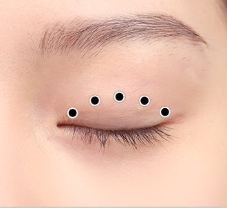 correction surgery 1 2 pc