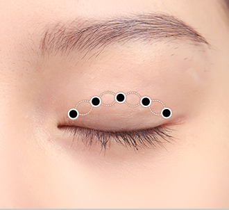 correction surgery 1 3 pc