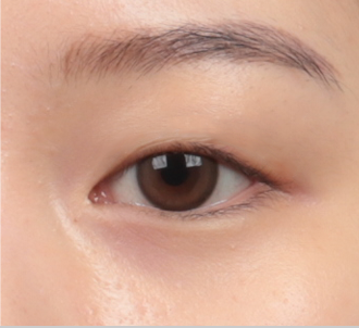 correction surgery 2 1 pc