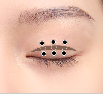 correction surgery 2 3 pc