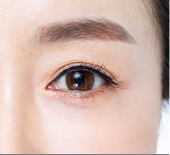 Blepharoplasty 47 e upper step 04 pc
