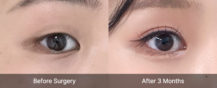 Natural Adhesion 24 eye natural view right