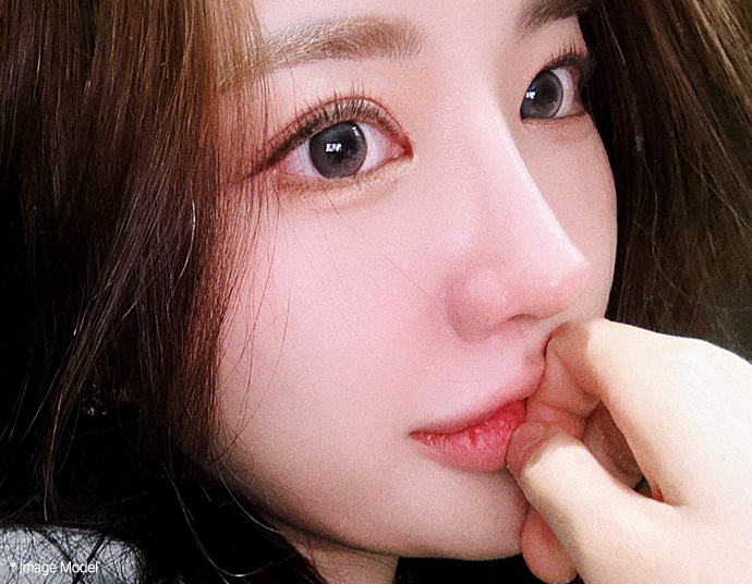 Under Eye Fat Reposition 23 eye province view left