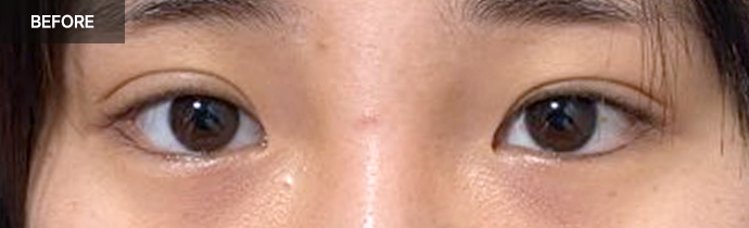 natural realselfi 1 pc