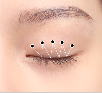 Natural Adhesion 36 natural surgery 2 pc