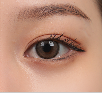 Natural Adhesion 40 natural surgery 4 pc