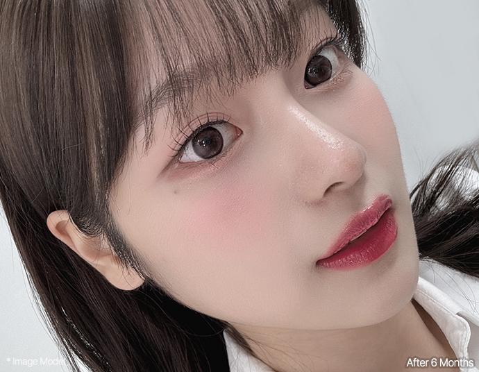 nose alar head pc