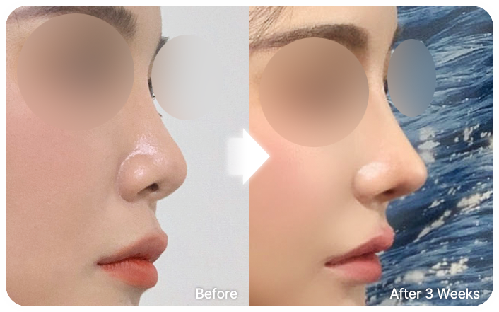 nose dev selfi 01