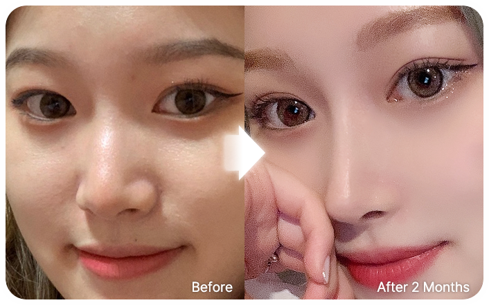 nose dev selfi 06